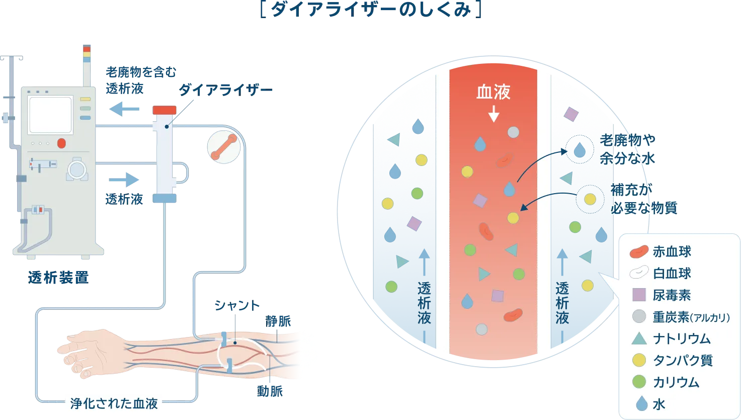 ダイアライザーのしくみ